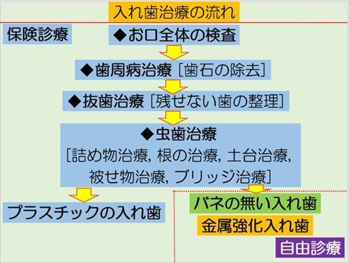 入れ歯治療の流れ_R.jpg