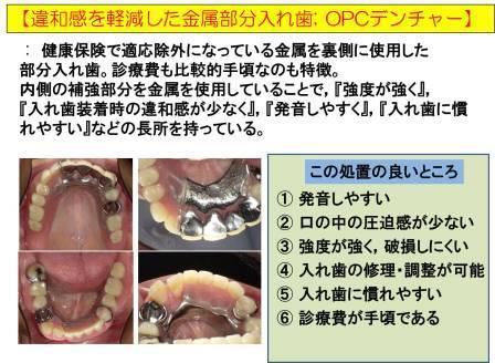 OPCデンチャー Web.jpg